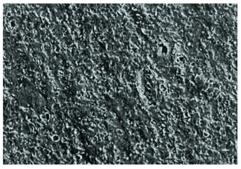 Microporous film (MPF) protective suit